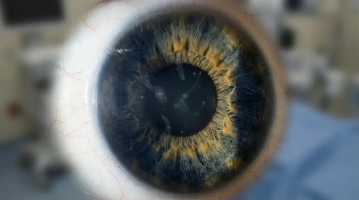 Moscas volantes (floaters) — sintoma de doença da retina